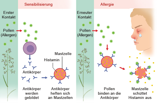 Grafik: Entwicklung einer Allergie - wie im Text beschrieben