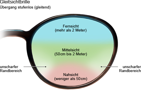 Grafik: Gleitsichtbrille mit stufenlosem Übergang (gleitend)