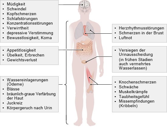 Grafik: Diese Symptome können einzeln oder in Kombination auftreten