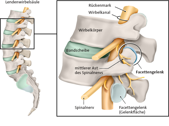 Die vereinfachte anatomische Grafik zeigt die Lendenwirbelsäule (links) und das Facettengelenk in Detailansicht (rechts).