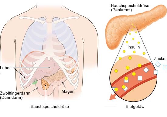Grafik: Lage der Bauchspeicheldrüse und Insulinzellen