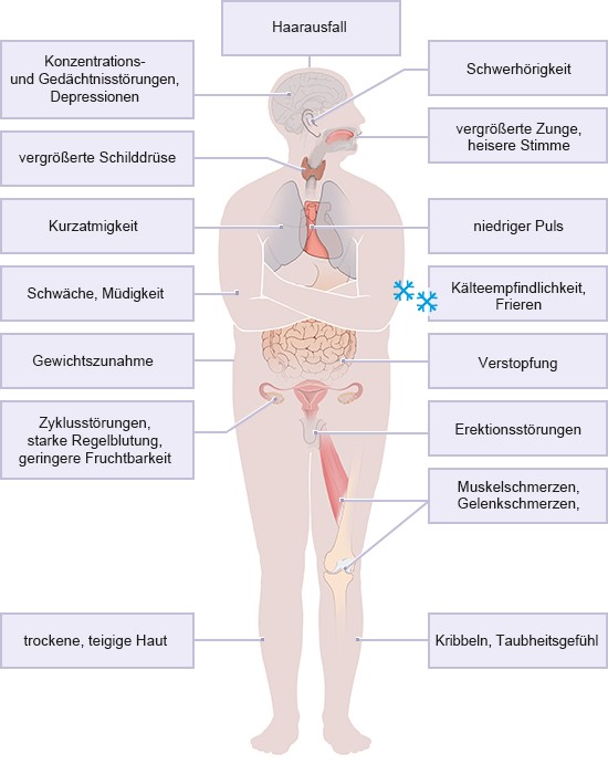 Grafik: Die Hashimoto-Thyreoiditis kann viele unterschiedliche Symptome hervorrufen