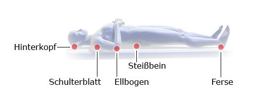 Die Grafik zeigt typische Entstehungsorte von Druckgeschwüren beim Liegen anhand eines Körpermodells in Rückenlage.
