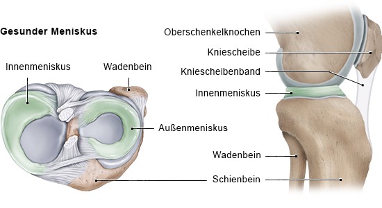 Grafik: Gesunder Meniskus (Ansicht: links Querschnitt rechtes Knie von oben, rechts seitlich)