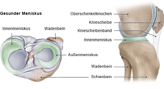 Grafik: Gesunder Meniskus (Ansicht: links Querschnitt linkes Knie von oben, rechts seitlich)