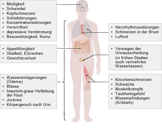 Grafik: Mögliche Symptome einer chronischen Nierenkrankheit 