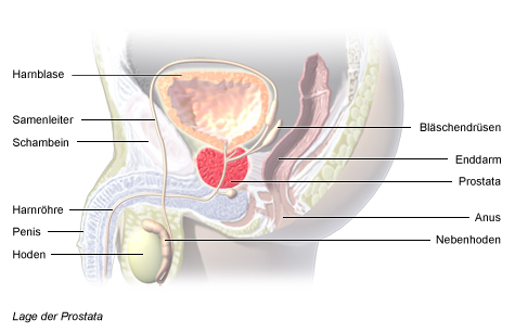 Grafik: Lage der Prostata - wie im Text beschrieben